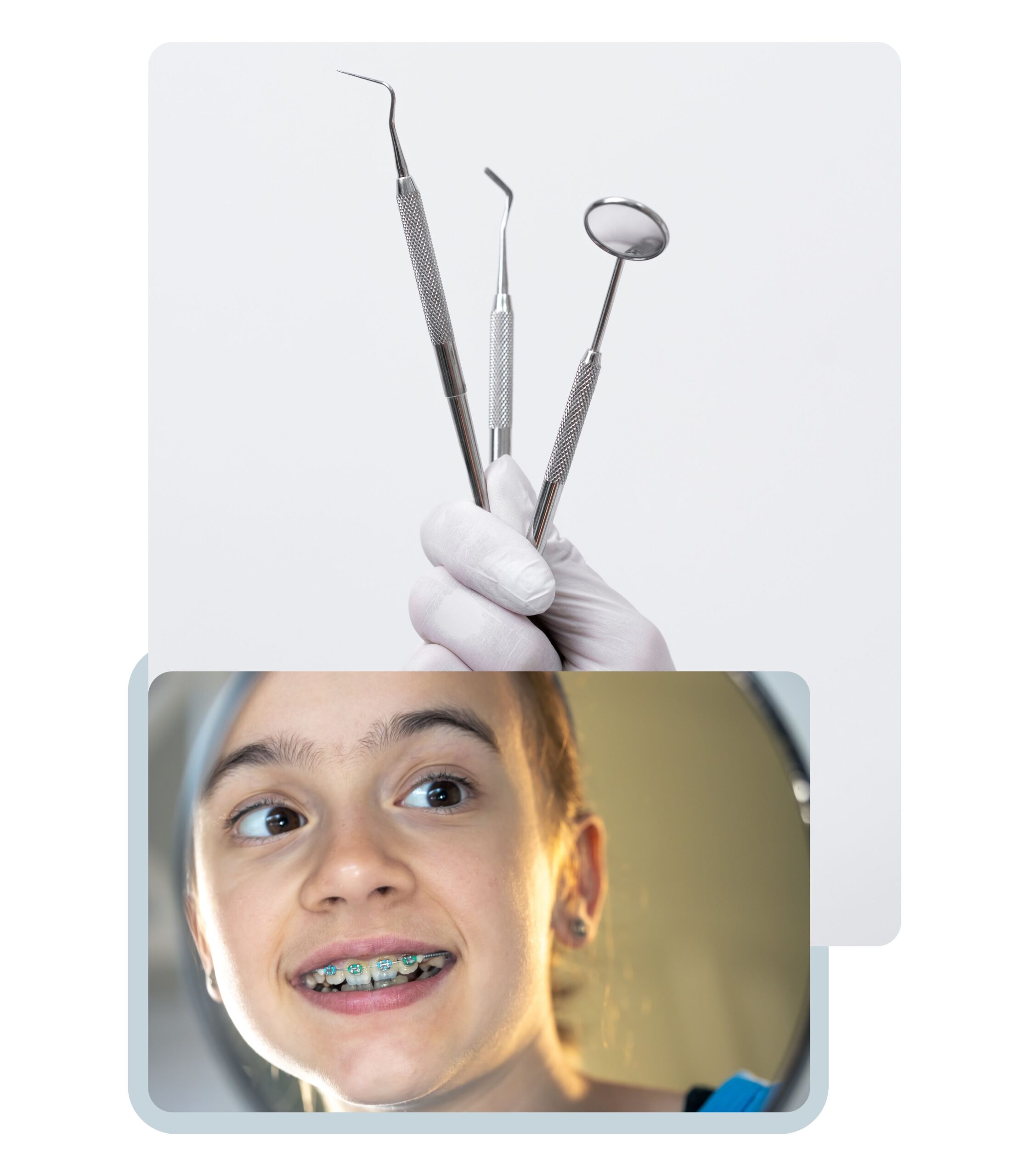 BRACKET TOKIO AUTOLIGADO brackets metálicos tokyo